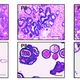 Image for article titled To Treat Cancer, Doctors Will Grow Miniature Organs from Your Tumors